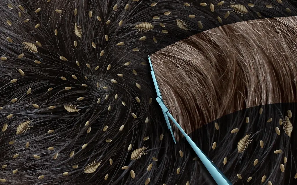 How to get rid of lice naturally in one day